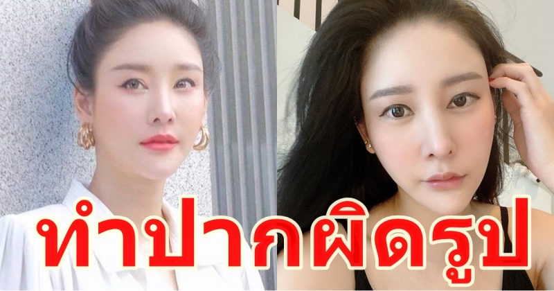 แตงโม นิดา เจอพิษศัลกรรมทำปากผิดรูป หมอตัดถูกเส้นประสาท !