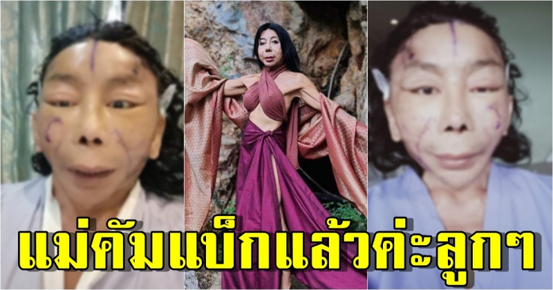 เผย ใบหน้าล่าสุด สิตางศุ์ บัวทอง หลัง อัพเกรดความสวย