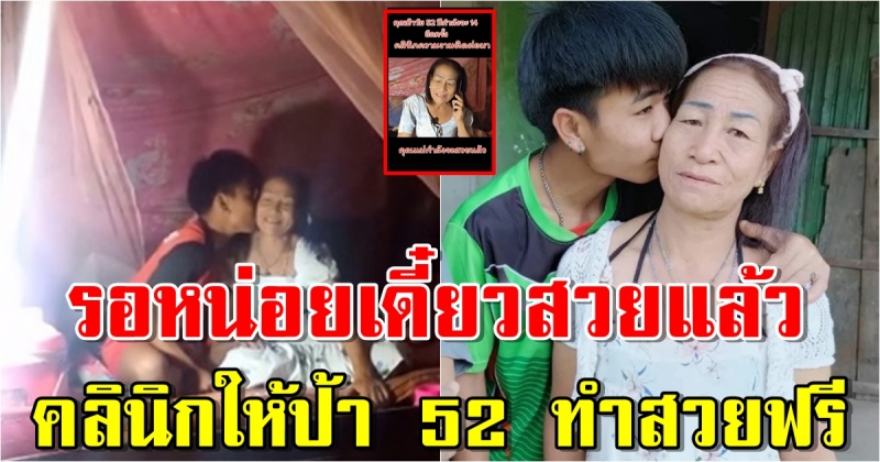 ป้าวัย52 ตอบตกลง คลินิกเสริมความงาม